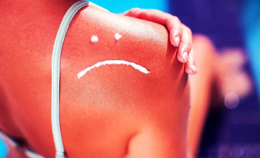 Päikesepõletuse peamine põhjus on lõpuks tuvastatud, aeg on õpikuid ümber kirjutada